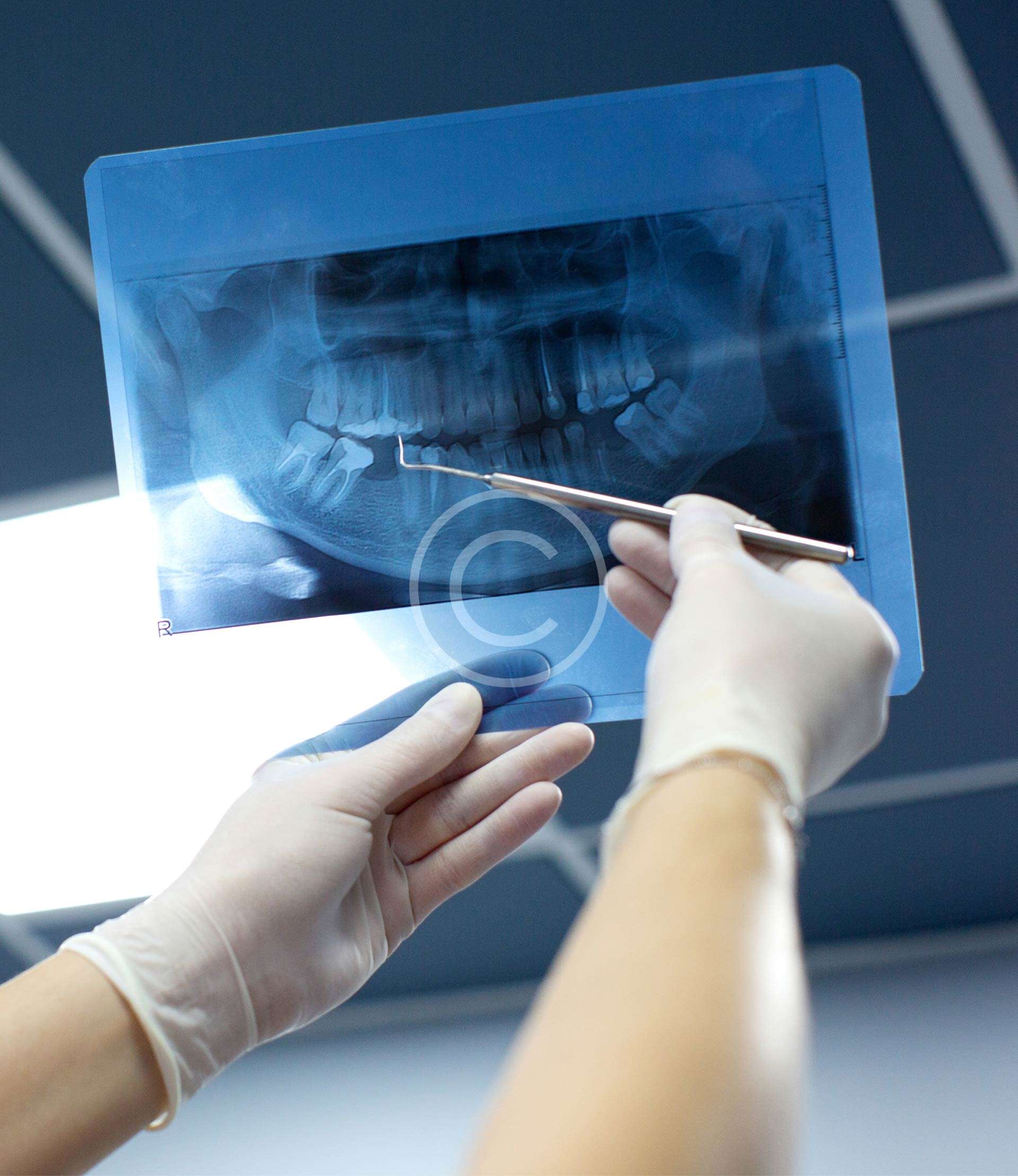 Dentalpost Radiograph Dental radiography – Sudanese British